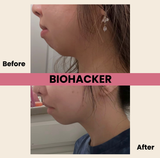 Biohackher - Biohackher Mouth Tape