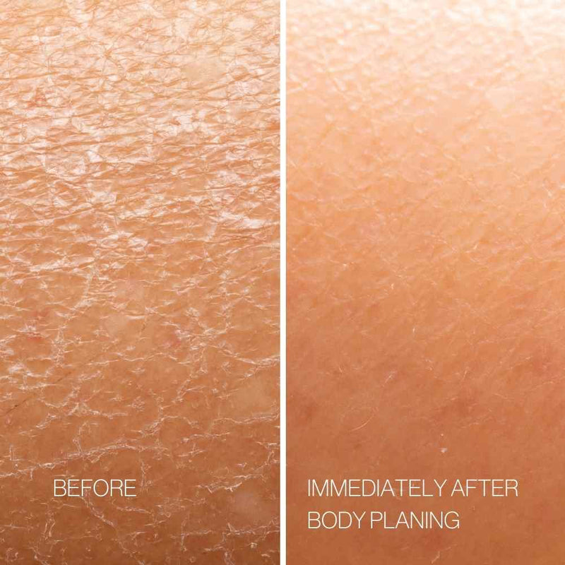 Body Plane Set